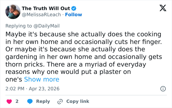 A mão enfaixada de Kate Middleton para as comemorações do centenário da falecida rainha Elizabeth gera especulações