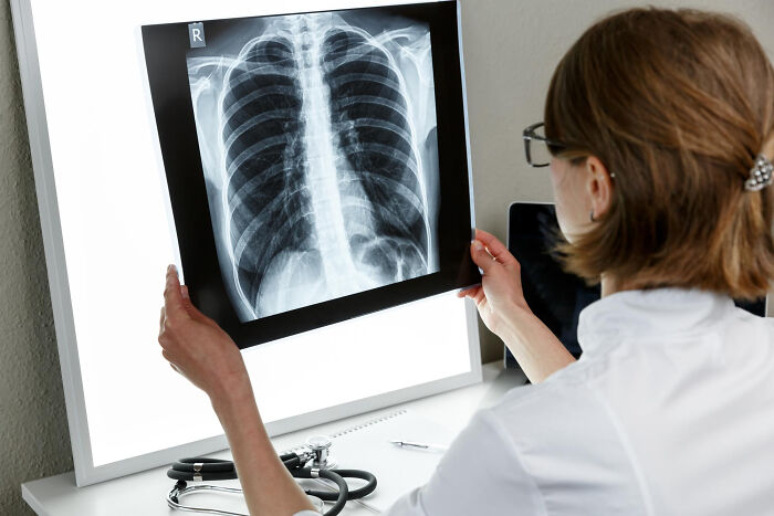 Doctor examining a chest X-ray on a lightbox, revealing random facts people learned about their bodies during checkups.