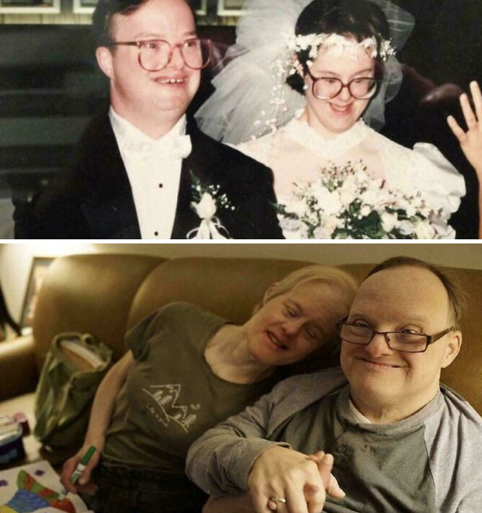 Couple Who Live With Downs Syndrome Celebrating 25 Years Of Marriage…