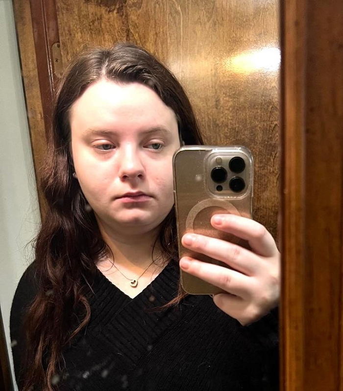 Mulher mostra sua transformação maluca, as pessoas não conseguem acreditar: "Preenchimento labial, botox, perda de peso"