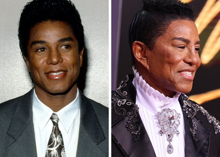 Side-by-side comparison of a Jackson family member showing changes through the years due to plastic surgery effects.