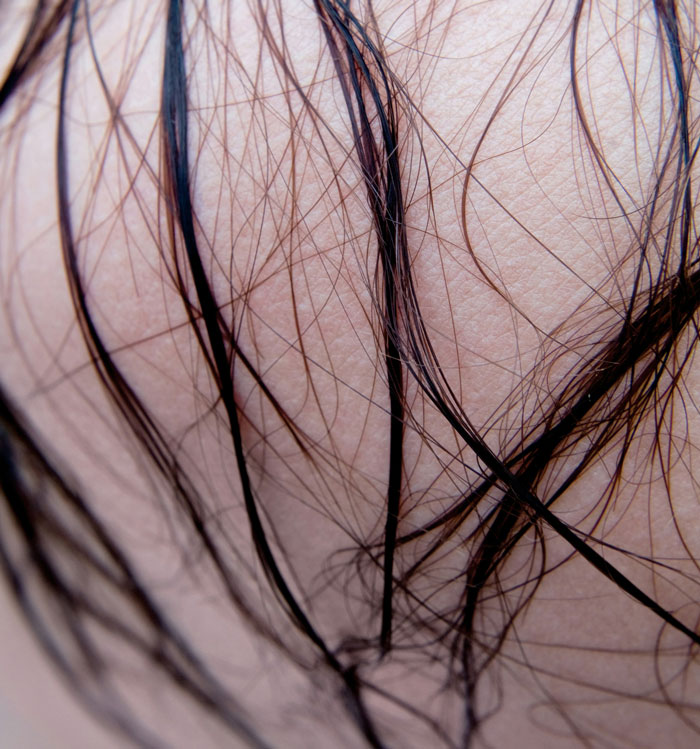 Close-up of a woman's skin with strands of hair, representing women tired of explaining their feelings to men.