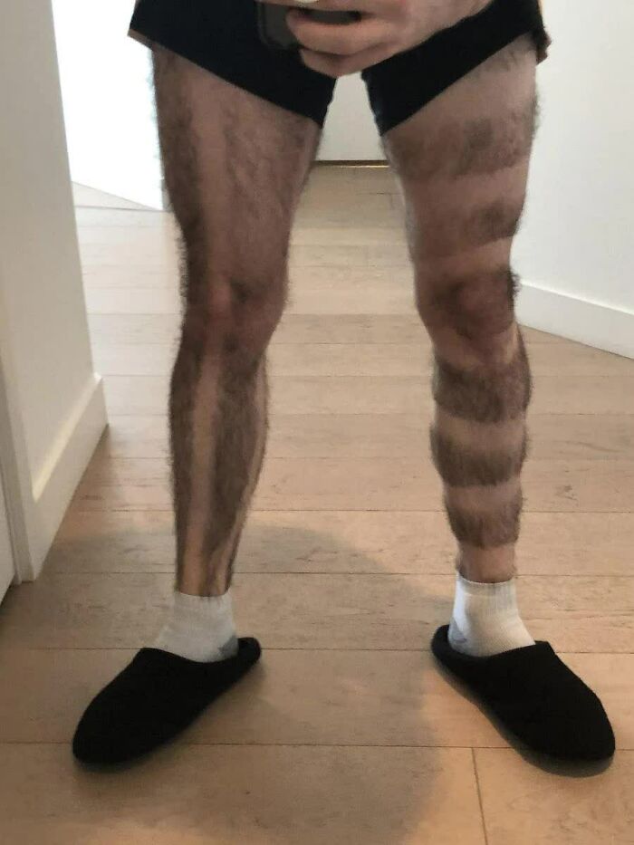 A person's legs with alternating shaved and hairy stripes, a truly weird image that lives in your mind rent-free.