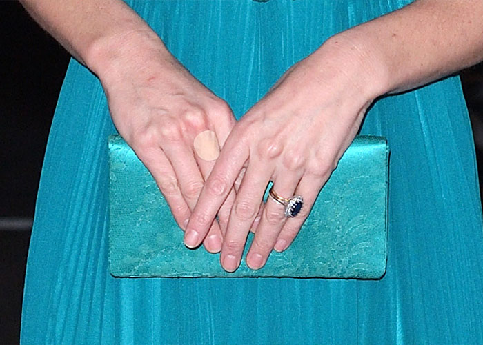 A mão enfaixada de Kate Middleton para as comemorações do centenário da falecida rainha Elizabeth gera especulações