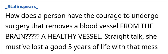 This Influencer Removed A Vein From Her Forehead Because It Bothered Her Aesthetically And Shared The Results