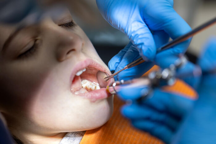 Close-up of a child’s mouth during a dental checkup revealing random facts people learned about their bodies.