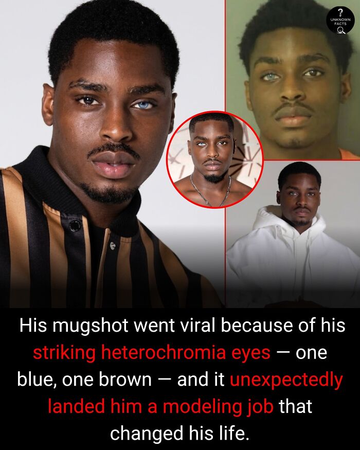 A man with heterochromia (one blue, one brown eye) in various photos, including a mugshot. Interesting facts about his modeling career.