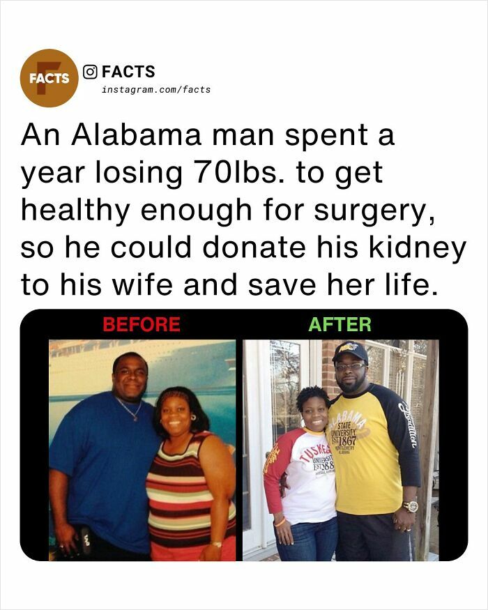 Before and after photos of an Alabama man who lost 70lbs for kidney donation to save his wife’s life in daily brain-care facts.