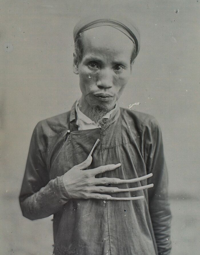 Rare and interesting photo of a man with extremely elongated fingernails from a time we will never experience.