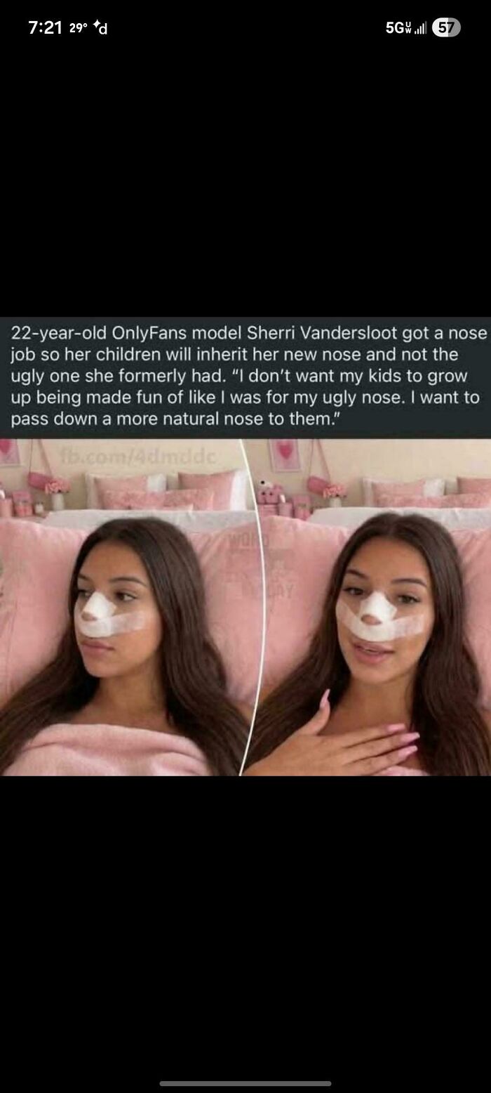 22-year-old OnlyFans model shares nose job story to prevent children inheriting her old nose in a depressing time.