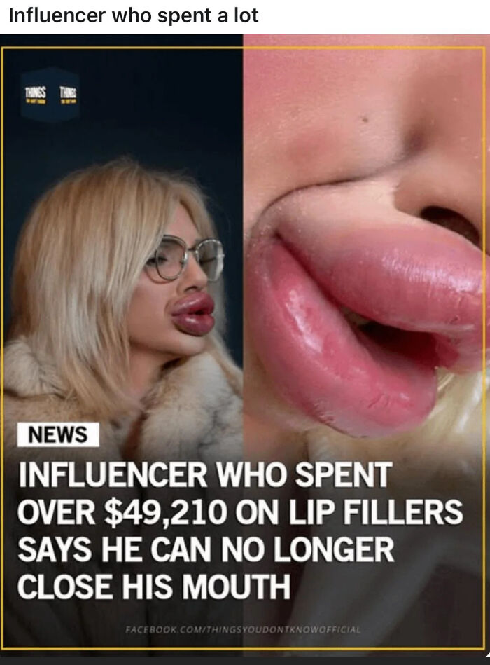 Influencer with exaggerated lip fillers unable to close mouth, highlighting depressing posts about living in a stupid time.
