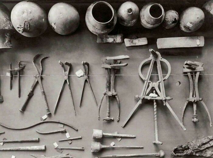 Ancient surgical and medical tools displayed as historical finds.