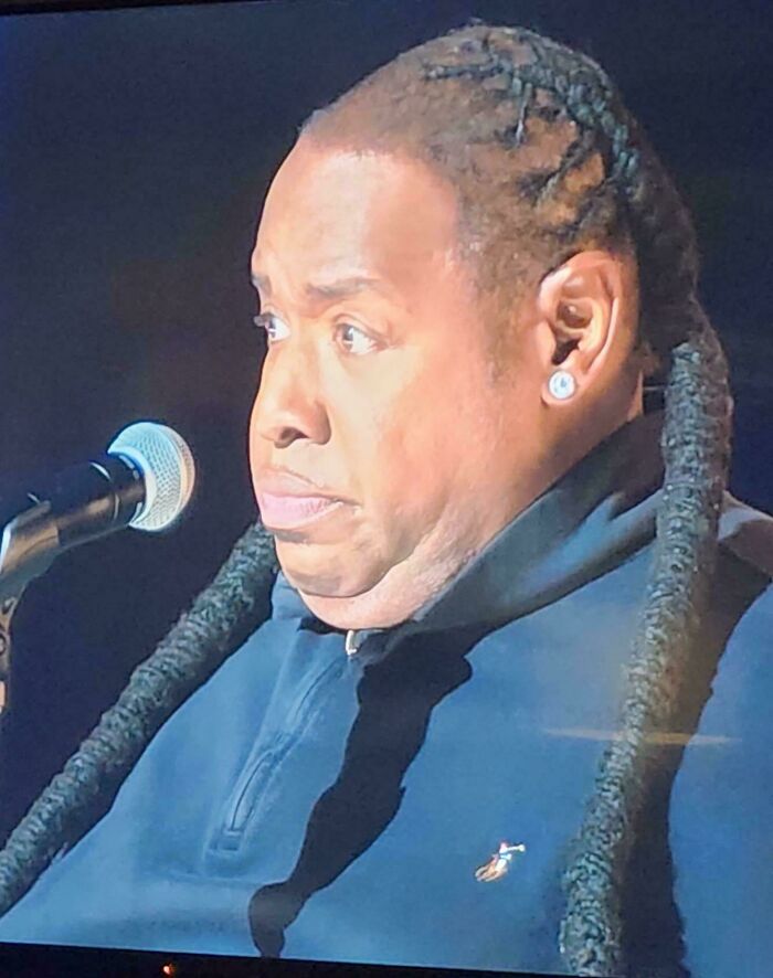 A man with dreadlocks and a receding hairline, a bad hair mistake, looks contemplative at a microphone.