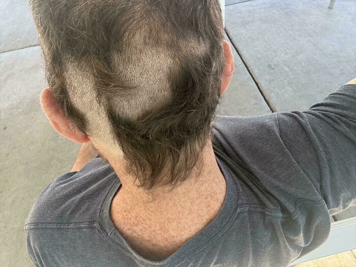 Overhead view of a person with a poorly executed shaved haircut and bad hair in the back.