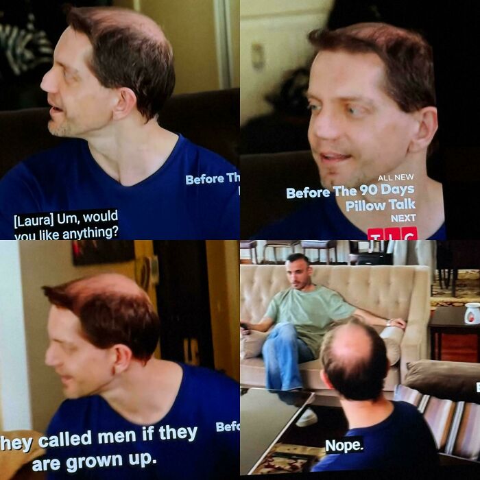 Four-panel image showing a man with noticeable bald spots and bad hair mistakes.