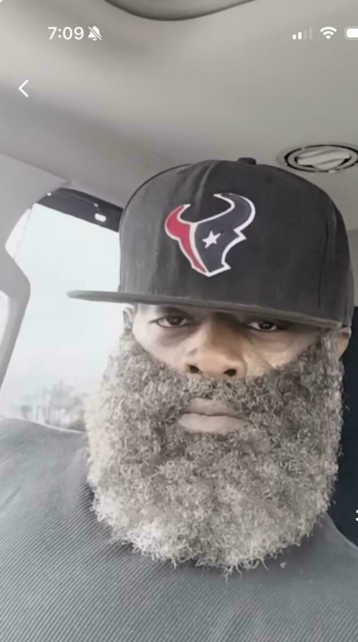 A man with a very long, gray, and hilariously bad hair mistake for a beard, wearing a baseball cap.