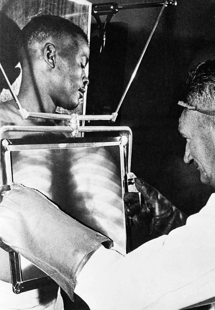 A black and white image of a man getting an X-ray of his chest, showcasing historical photos of medical practices.