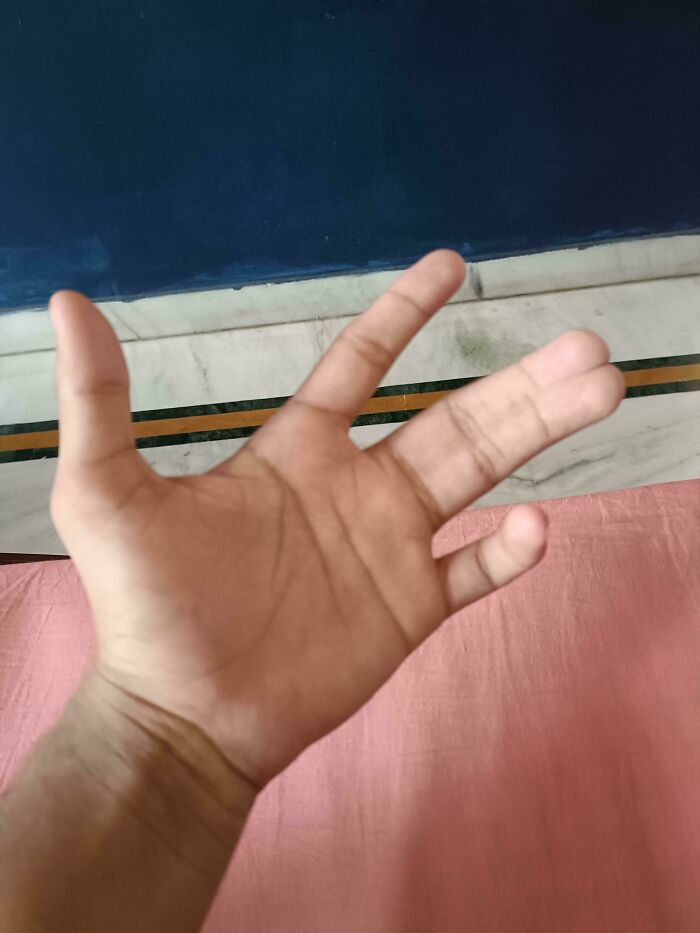 A hand with an unusual number of fingers. Fascinating pics & quick facts for a brain boost.