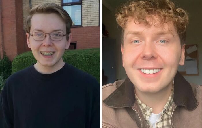 Side-by-side photos showing an extreme glow-up transformation with a young man smiling before and after.