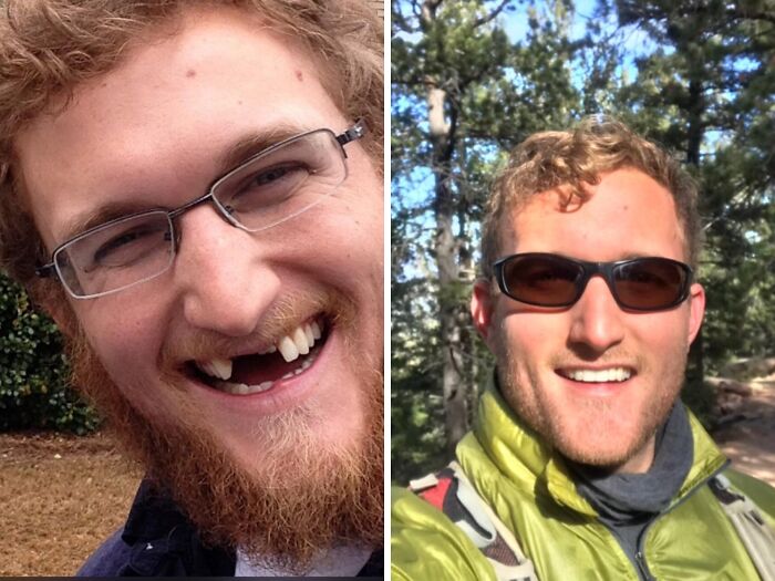 Side-by-side extreme glow-up transformation of a man smiling with glasses and then with sunglasses outdoors in a forest.
