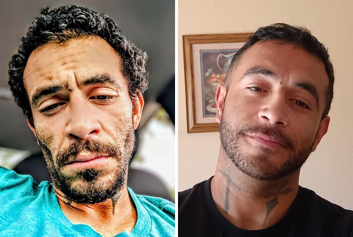 Side-by-side images showing an extreme glow-up transformation of a man with noticeable facial changes.