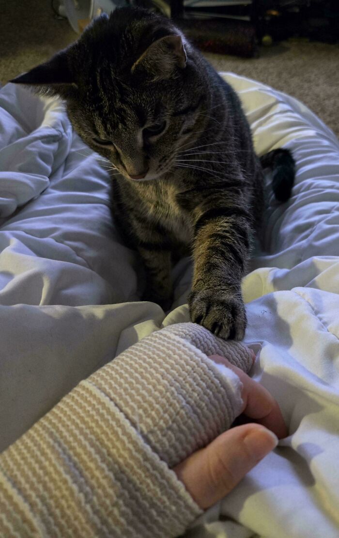 Tabby cat gently touching a person's casted hand, illustrating cats with jobs in a cozy indoor setting.