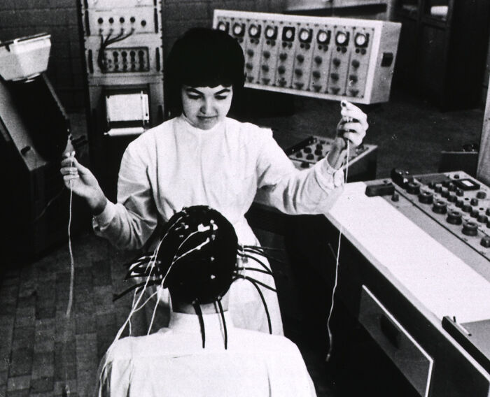 Vintage medical device with electrodes attached to patient’s head in a clinical setting showcasing early healthcare technology.