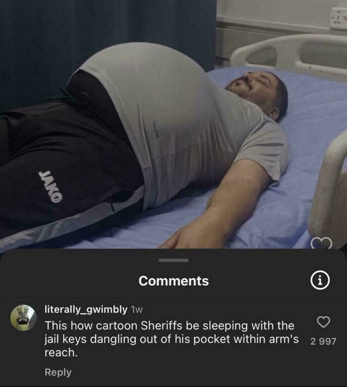A man lying on his back in a hospital bed with an extremely distended belly, showing an epic burn.