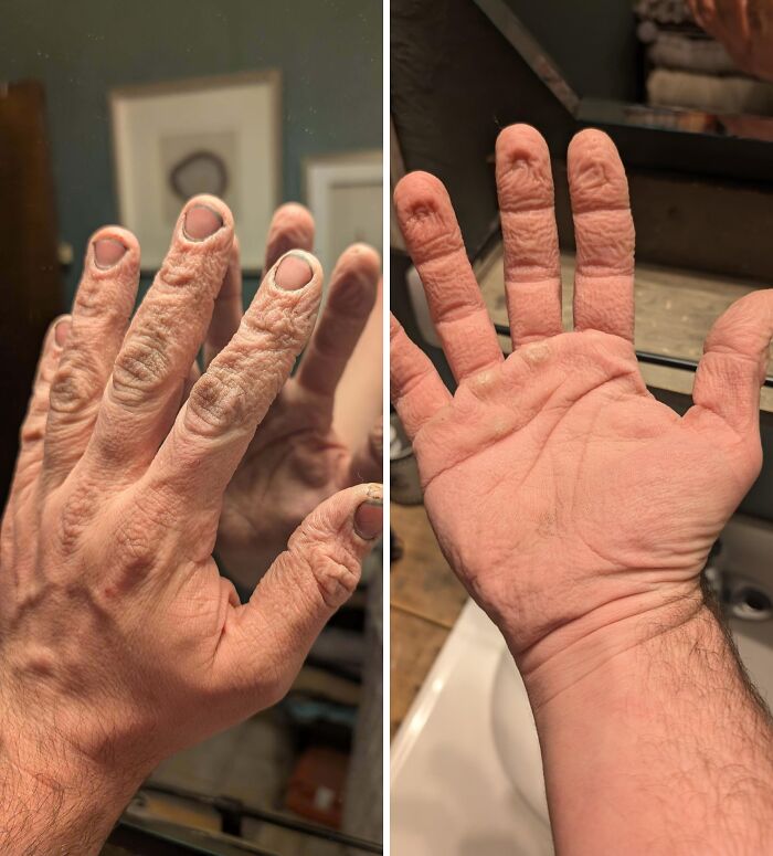 Close-up of car mechanic's hands showing dry, rough skin from work, illustrating the reality of their tough job.