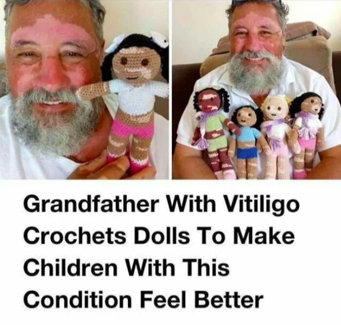 Smiling grandfather with vitiligo holding crocheted dolls that promote positivity and support for children with the condition.
