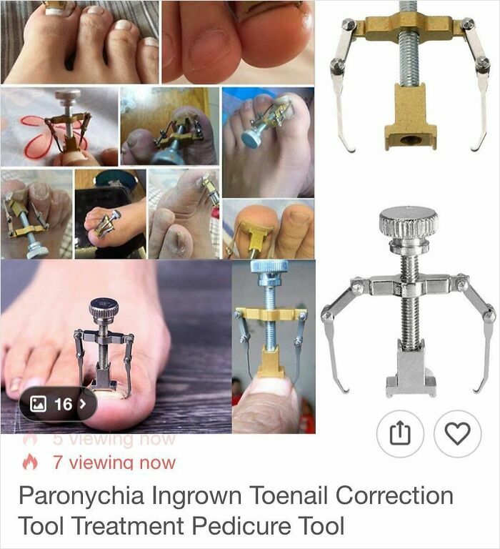 Ingrown toenail correction tool shown from multiple angles and in use, highlighting unusual shopping finds on Wish.