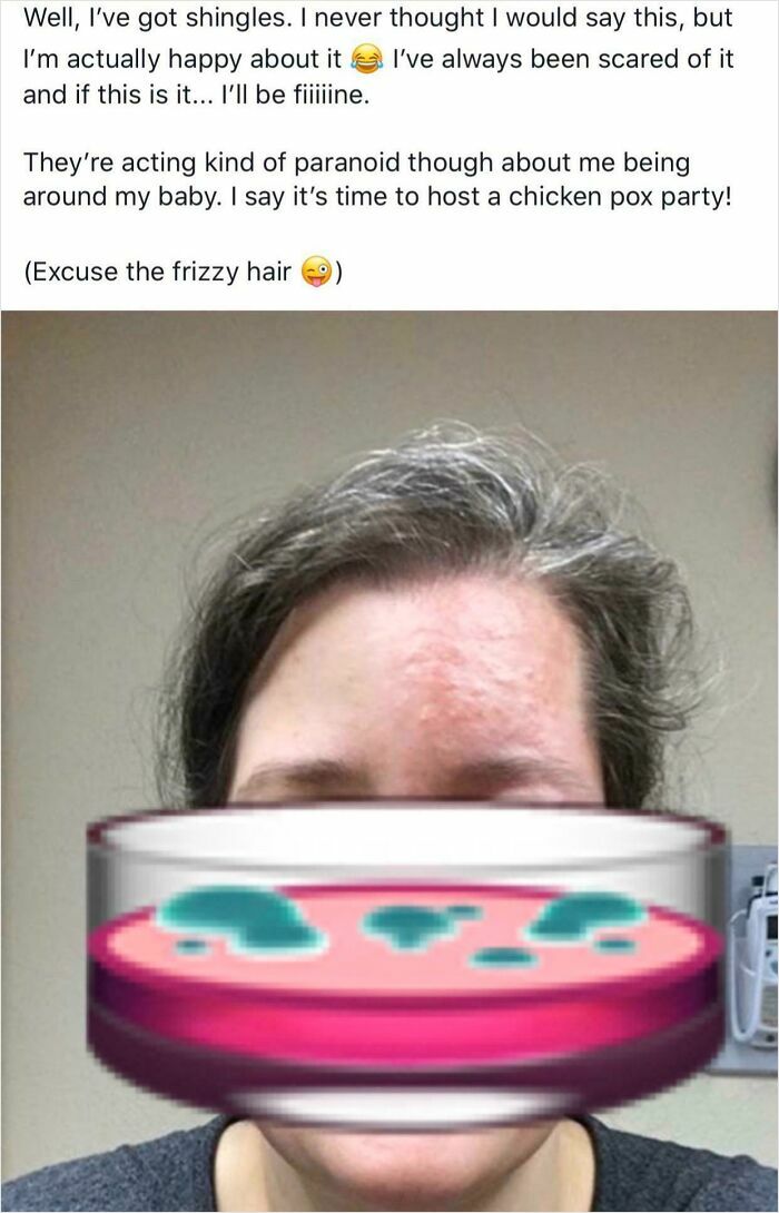 Woman with shingles rash on forehead, discussing paranoia around baby, representing irresponsible and toxic mothers online.
