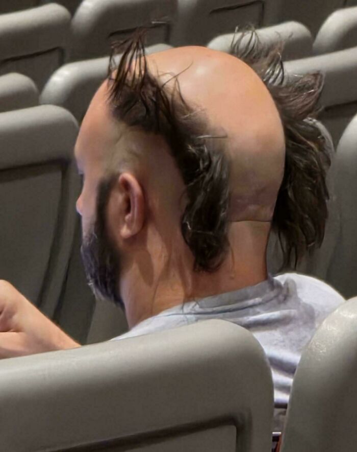 A man from behind, revealing a very unfortunate haircut with sparse hair on the sides and back of his bald head.