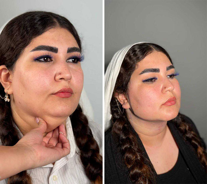 These Viral Face Transformations Look Like Something Is “Snapping” Into Place — And People Are Obsessed (21 Pics)- Interview