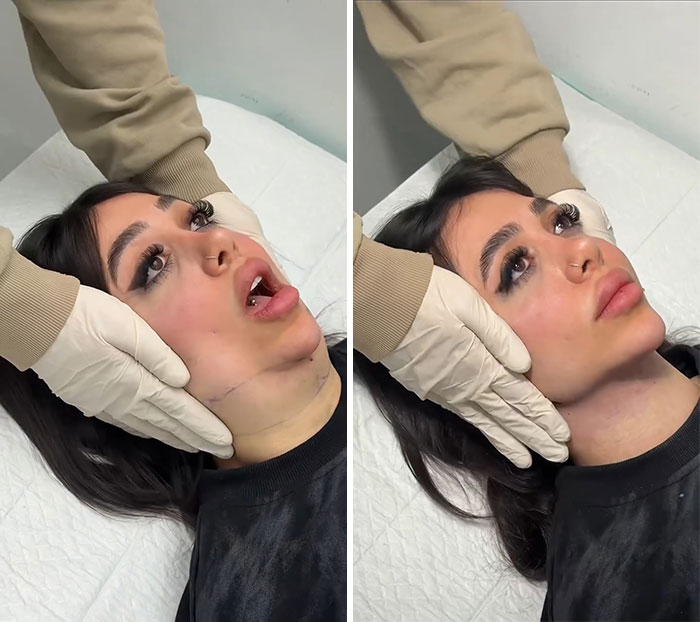 These Viral Face Transformations Look Like Something Is “Snapping” Into Place — And People Are Obsessed (21 Pics)- Interview