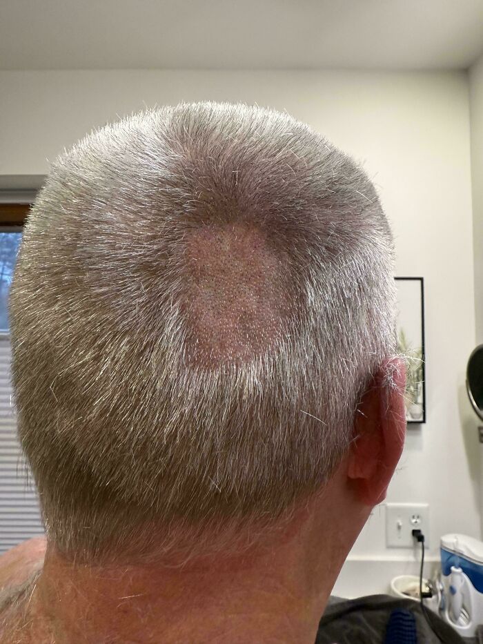 A person's short, gray hair from the back, revealing a noticeable bald patch. A hair disaster indeed!