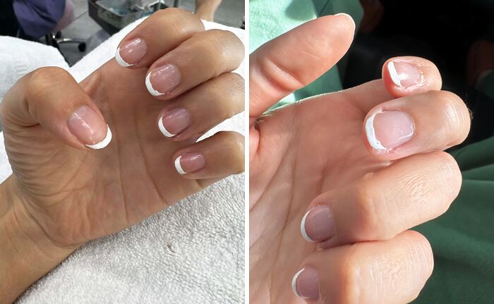 A woman's hands show a beauty disaster: two fingernails with poorly done French tips, one with chipped polish.