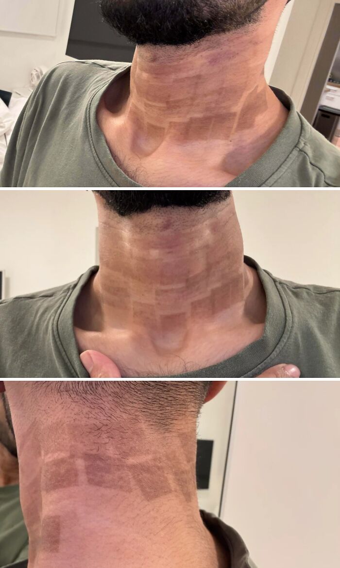 Close-up of a person's neck with uneven, rectangular-shaped tan lines. A clear example of a beauty disaster.