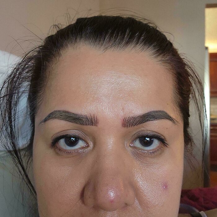 A woman with poorly microbladed eyebrows that appear uneven and unnaturally drawn, a common beauty disaster.