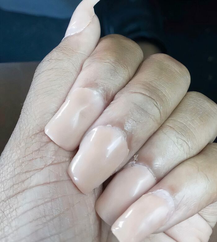Close-up of a hand with poorly applied acrylic nails, showing a beauty disaster in a salon setting.
