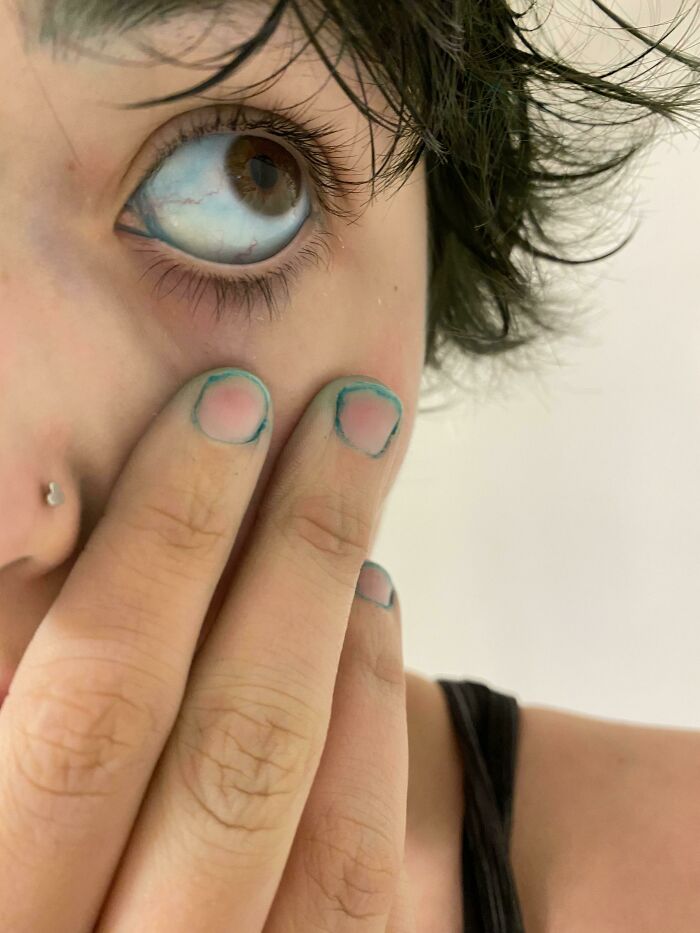 Close-up of a person's eye, looking up. Two fingers lightly touch their cheek, nails outlined in blue, depicting a beauty disaster.