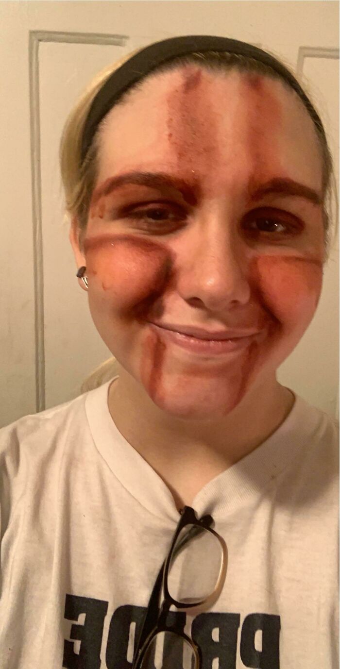A woman with a beauty disaster, reddish-brown stains streaking her face from forehead to cheeks. She smiles faintly.