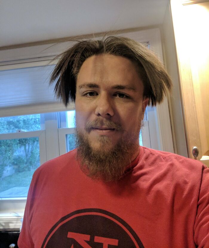 A man with an uneven haircut and a beard, showcasing a funny beauty disaster.