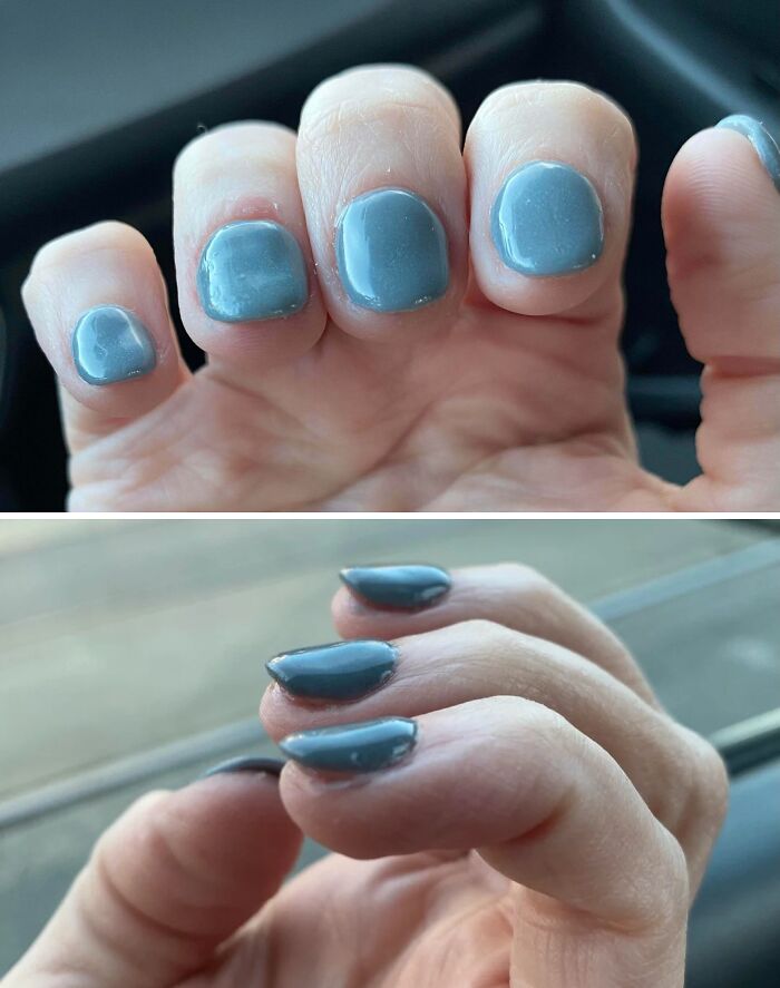 A person's hand with poorly applied light blue nail polish, showing visible mistakes. A true beauty disaster.