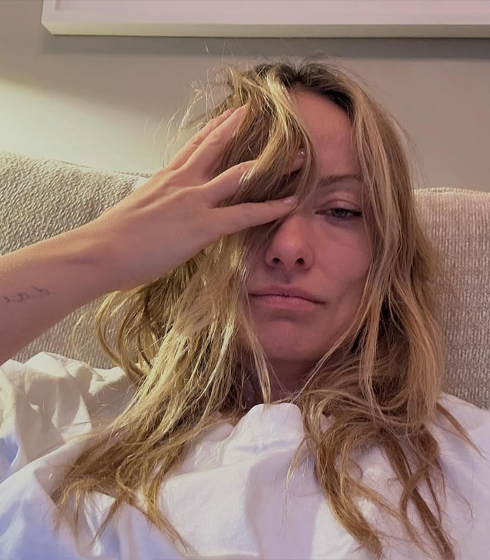 Olivia Wilde, looking disheveled with messy blonde hair and a hand covering part of her face, triggering medical cadaver concerns.