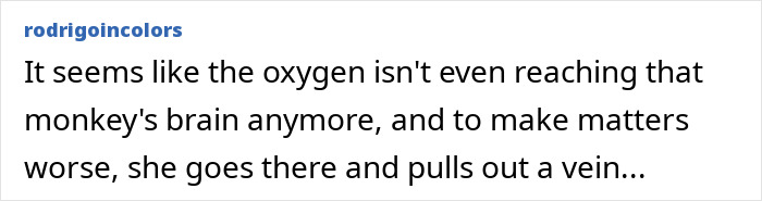 This Influencer Removed A Vein From Her Forehead Because It Bothered Her Aesthetically And Shared The Results