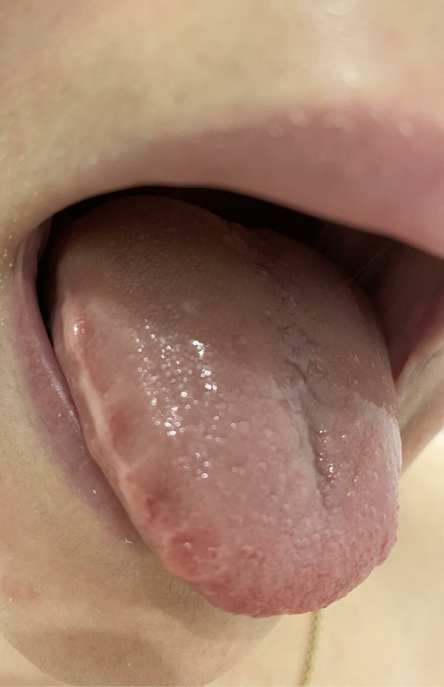 Close-up of an open mouth revealing a tongue with varied texture and color, illustrating bizarre human body quirks.