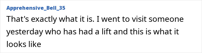 All The Signs Pointing To Your Coworker’s Secret Plastic Surgery, From Bat Ears To Bunny Nose And A Hairstyle Change All The Signs Pointing To Your Coworker’s Secret Plastic Surgery, From Bat Ears To Bunny Nose And A Hairstyle Change