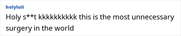 This Influencer Removed A Vein From Her Forehead Because It Bothered Her Aesthetically And Shared The Results