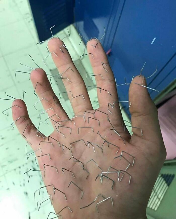 A human hand covered in staple wires, a truly cursed image that confuses and creeps viewers.